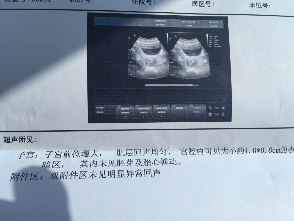 超声检测到胚胎停止发育的报告