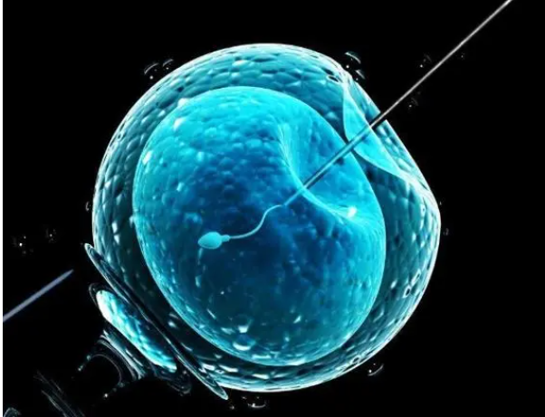 试管婴儿：精子选择、采集和处理——从生物学到实验室的全面解析
