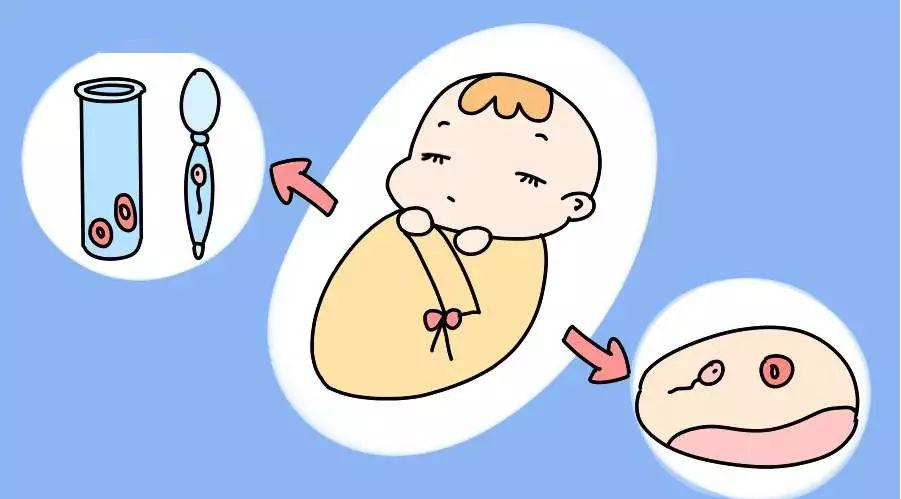 试管婴儿：避免出生缺陷的新选择